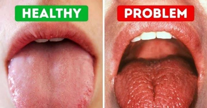 5 Reasons Why You Still Have Mouth Odour And How to Solve It