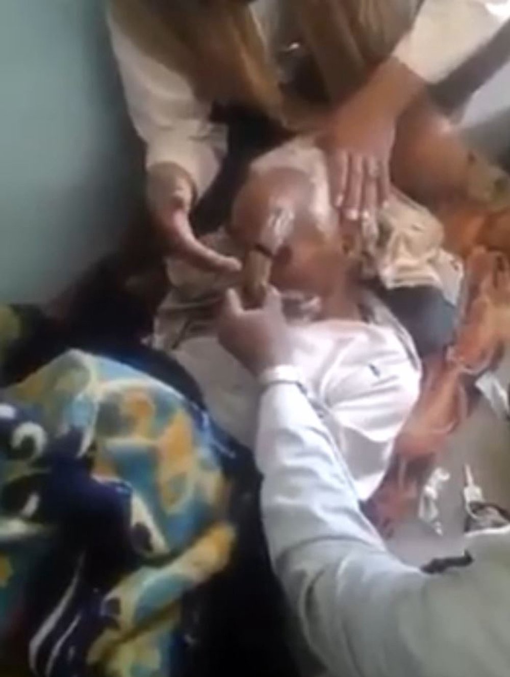 Shortly before his death, he attempted to have his horn removed