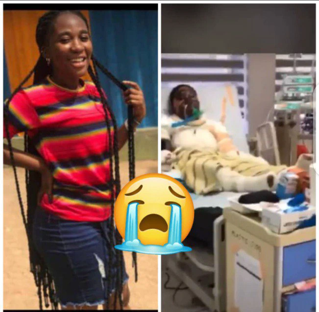 KASOA: Tears Flow As Beautiful Twin Lady Dies After Getting Burnt In Gas Explosion