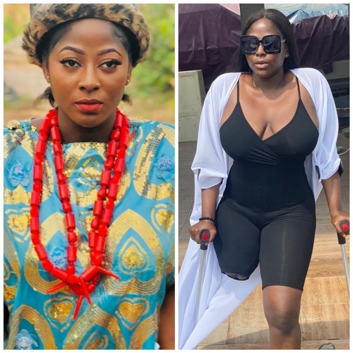 Meet the beautiful amputee actress making it big in life - Photos + Videos