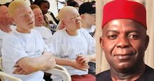 Abia albinos seeks Governor Otti’s support