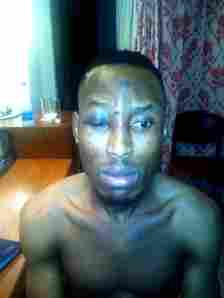 Mr 2Kay after the assault by robbers in his hotel room