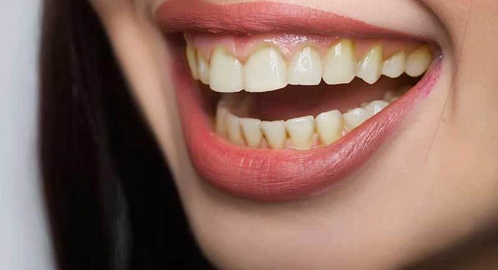 why my teeth yellow why my teeth yellow