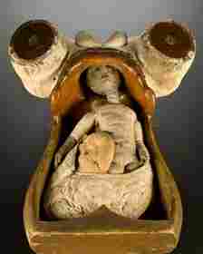 Obstetric Phantom, 18th Century. The Wood And Leather Model Was Used To Teach Medical Students, And Possibly Midwives, About Childbirth. It Came From The Hospital Del Ceppo In Pistoia, Near Florence, Founded In 1277