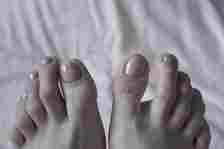 Why Are Your Toes Curling Down? - HealthyWomen