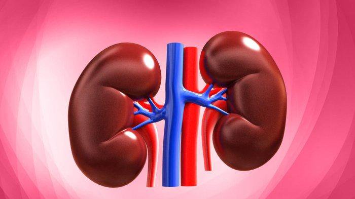 Kenali Tanda-tanda Penyakit Ginjal Sudah Akut, Cegah Sebelum Terlambat