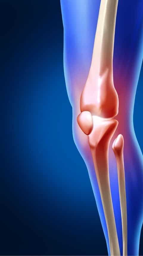 Bone Weakness and Osteoporosis