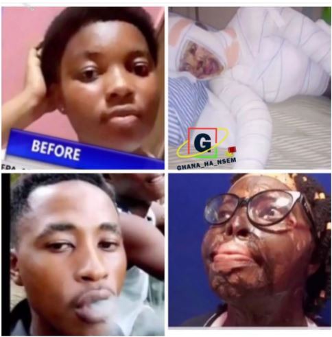 Boy pours acid on his girlfriend after she refused to do a blood covenant with him