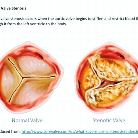 boil strain unripe syphilis