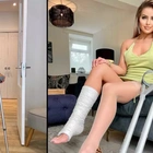 Woman makes £5,000-a-month pretending to have broken legs