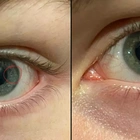 Woman worried her boyfriend is ‘factory made’ after spotting weird detail inside his eye