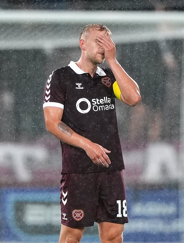 Harry Milne is facing a lengthy lay-off (Andrew Milligan/PA)