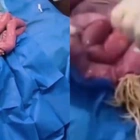 Chilling footage shows what happens when giant parasitic WORMS enter the gut - and 4million Americans could suffer unknowingly