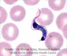 Chagas Disease May Up Chronic Heart Disease Risk