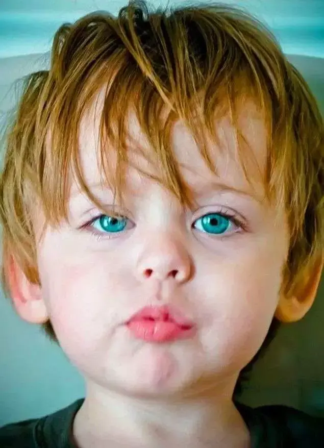 Wonderful! Photos Little Kids That Were Born With Strange Eyes