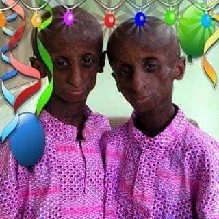 Remembrance Of Taiwo and Kehinde Osuolale:Twins Actors Who Are Known As 'Ibeji Oran'