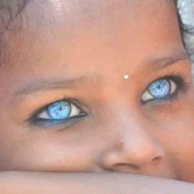 Wonderful, Photos Kids That Where Born With Strange Eyes (Opinion)