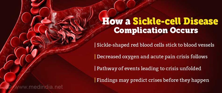 How Does Acute Pain Crisis in Sickle Cell Disease Arise?