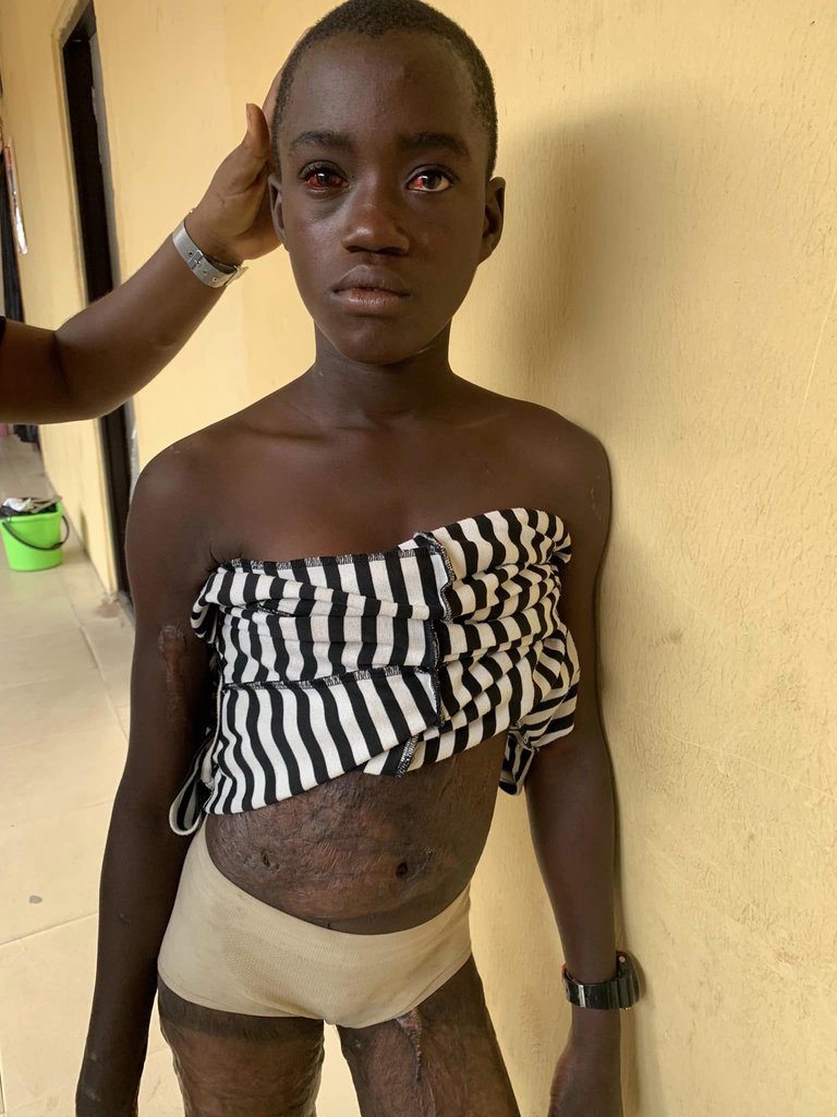 Woman subjects her 12-year-old stepdaughter to h0rrific ab*se with kn!fe, cutlass and fire for eating food without her permission (video)