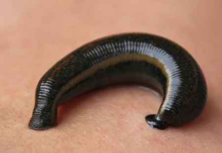 leech brains