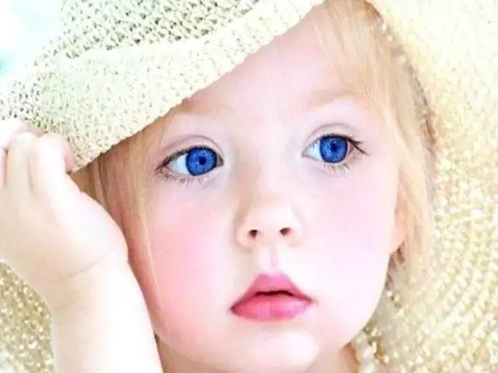 Wonderful! Photos Little Kids That Were Born With Strange Eyes
