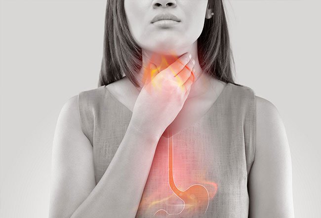 Heartburn: Symptoms, Causes, Medications, Treatment & Prevention