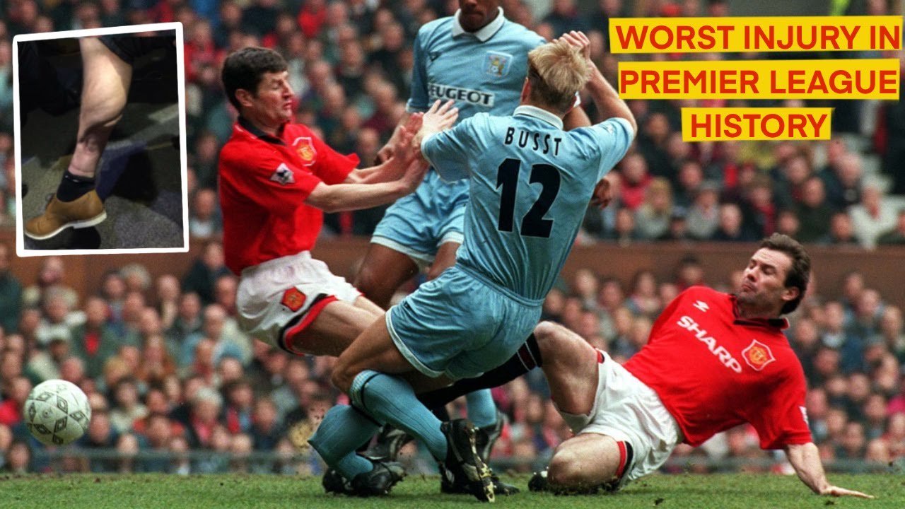 DAVID BUSST BROKEN LEG turned into the WORST INJURY in PREMIER LEAGUE  FOOTBALL | HISTORIC INJURIES#7 - YouTube