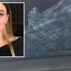 Michigan Teen Sends Out SERIOUS Warning That Goes Viral After Discovering Flannel Shirt On Her Windshield