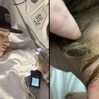 Teen almost dies in phone charger accident after chain is electrocuted into his neck