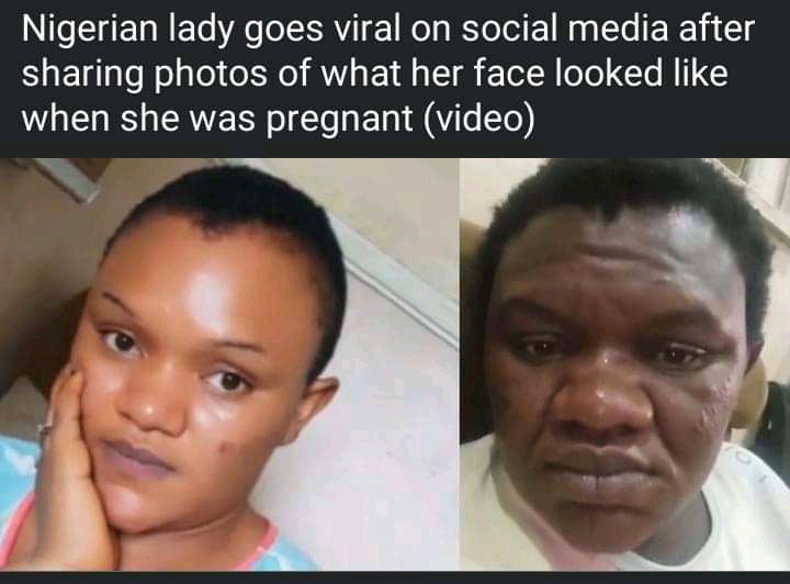 Pregnancy will humble you; see before and after photos of a lady who got pregnant.