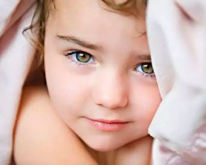 Wonderful! Photos Little Kids That Were Born With Strange Eyes