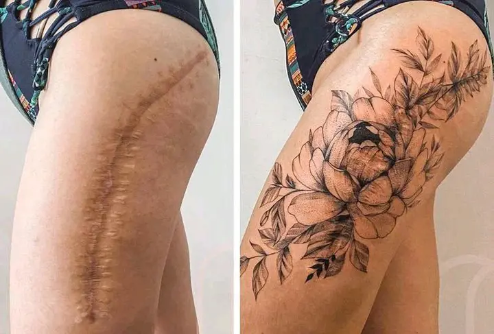 Transformation Twenty-Two Scars Into Beatify Tattoos