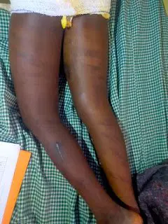 woman burns 11-year-old maid