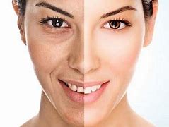Image result for 5 Tips to Reduce Deep Wrinkles