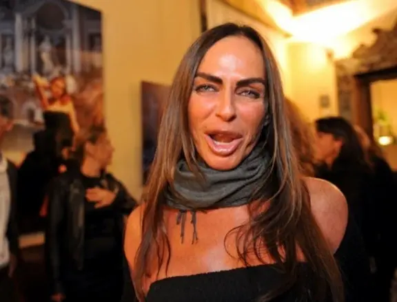 SURGERY GONE WRONG: Much Surgery Turned This Lady Look (See Photos)