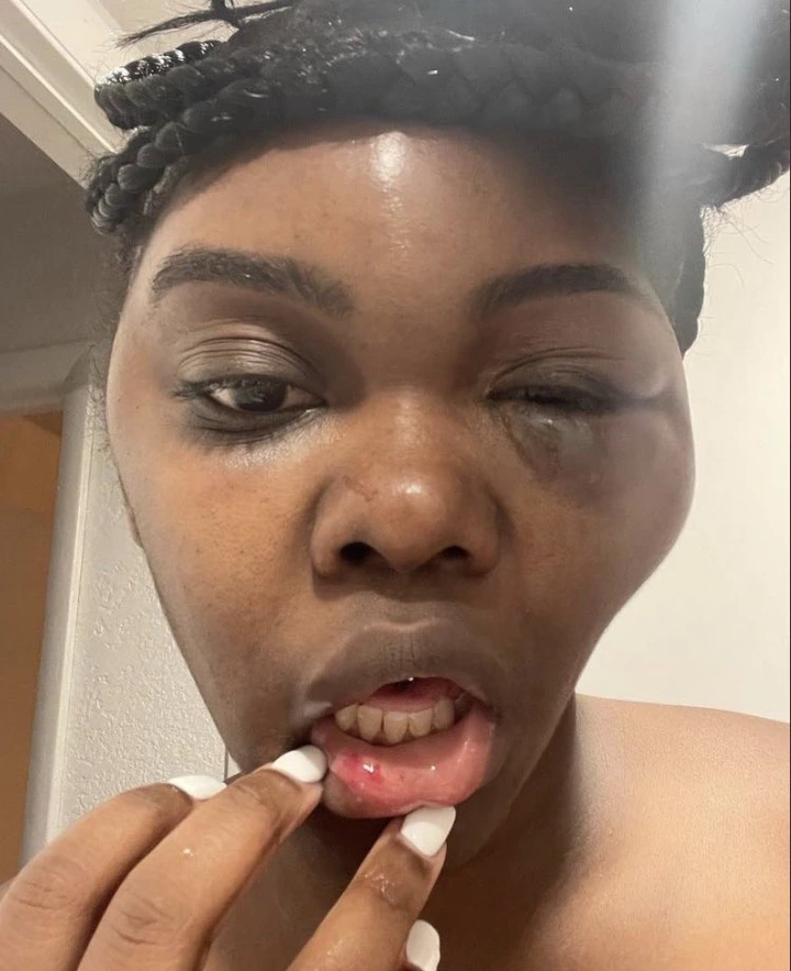See how a man disfigured the face of his beautiful girlfriend with beatings (photos)