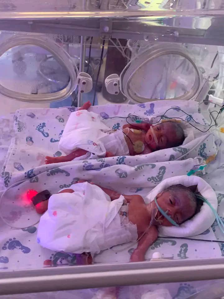 Husband to lecturer who delivered septuplets says she remained unconscious 3 days after birth - anambra lecturer septuplets
