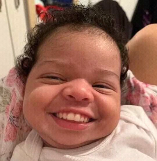 See Photos of the cute baby girl born with a full set of teeth.