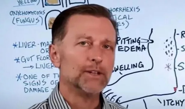 Dr Eric Berg, author of the The Healthy Keto Plan and known as The Knowledge Doc, has warned of the symptoms that could be found on the feet
