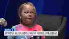 Six-year-old Lillian has been left with extensive nerve damages and cuts to her face and neck. (YouTube/WNEM TV5)