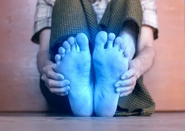 Cold toes can be caused by several underlying health conditions