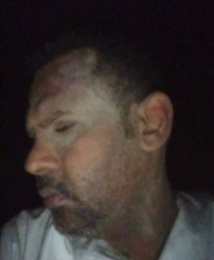 9166c064edb3c3267909210af4d68c3b?source=nlp&quality=hq&format=webp&resize=720