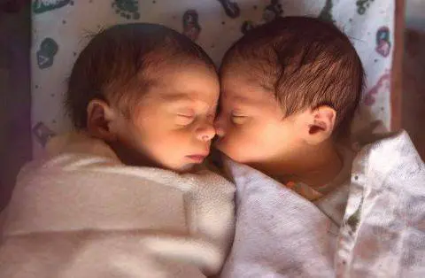 Wonderful This Twin Sisters Were Born With Totally Different Looks (Photos)