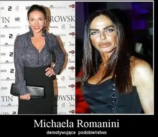 SURGERY GONE WRONG: Much Surgery Turned This Lady Look (See Photos)