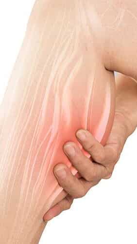 Muscle Cramps and Spasms