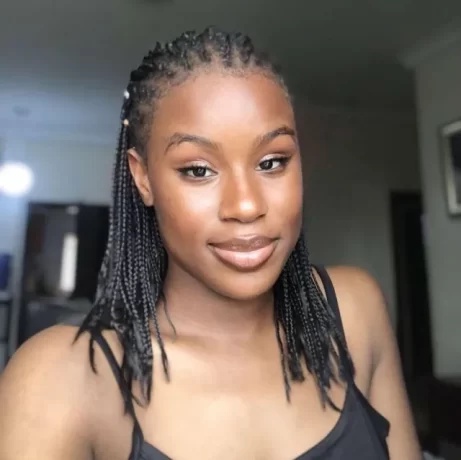 "I Never underwent any Surgery"- Burn writes as shows off her amazing transformation as skin heals without blemish; Reveals what she used(photos)