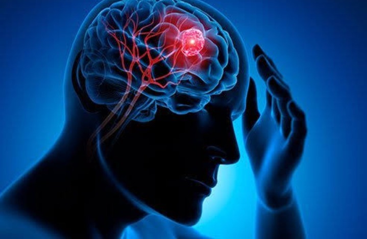 5 Conditions That Might Trigger internal bleeding 3 9ce98bda41ad4f6c95bbe02d41fe260b?quality=uhq&resize=720