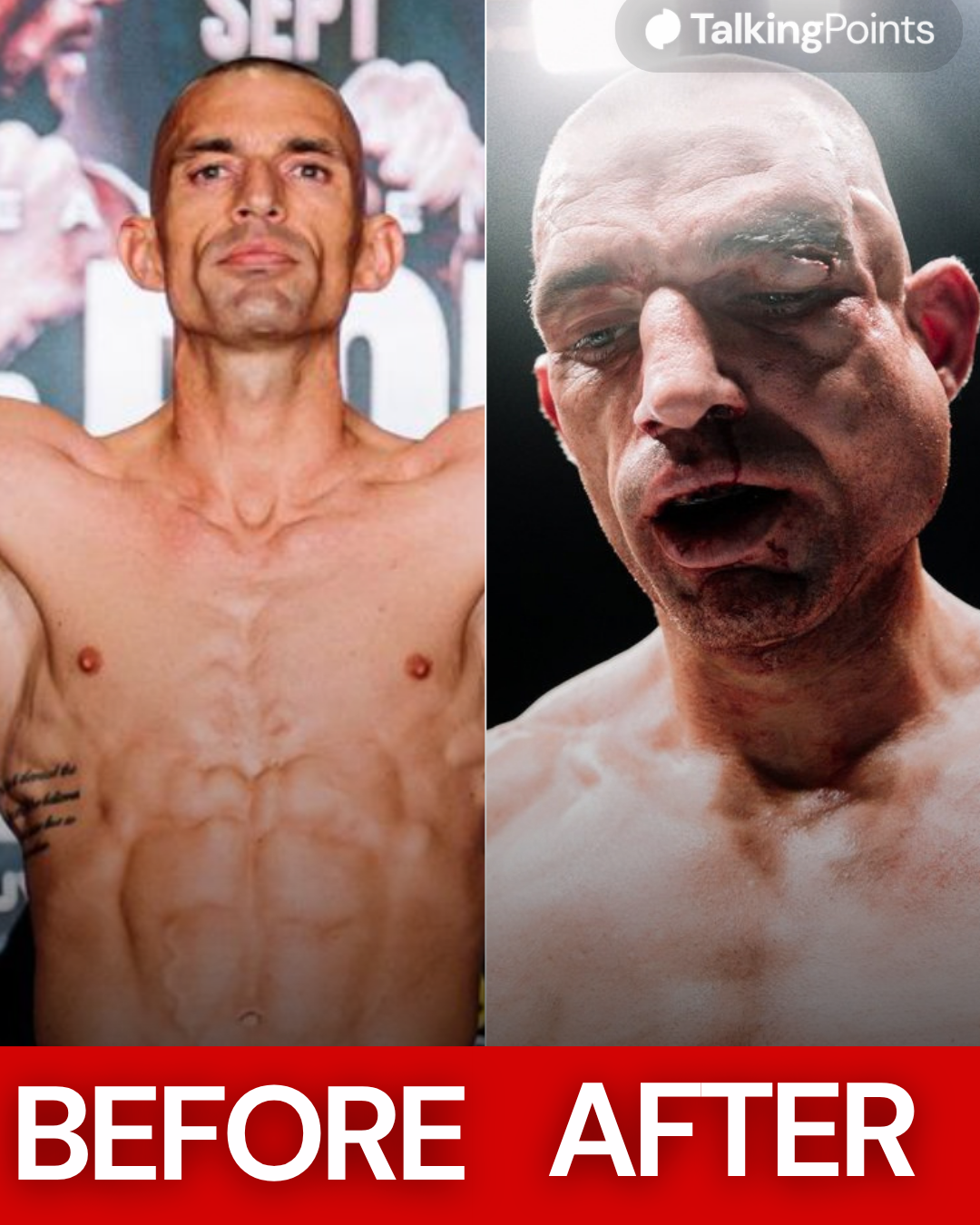 Ste Wallwork before and after his fight at BKFC 94