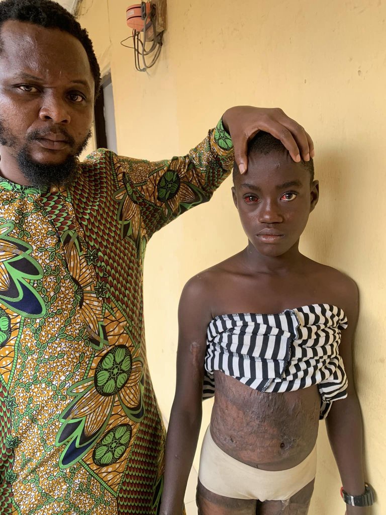 Woman subjects her 12-year-old stepdaughter to h0rrific ab*se with kn!fe, cutlass and fire for eating food without her permission (video)