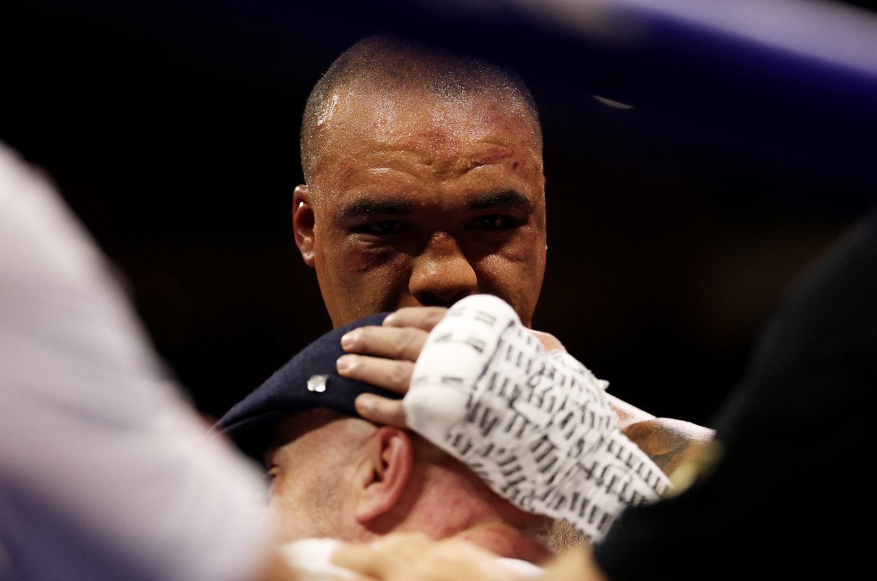 Fabio Wardley after his second-round loss to Daniel Dubois (Reuters)
